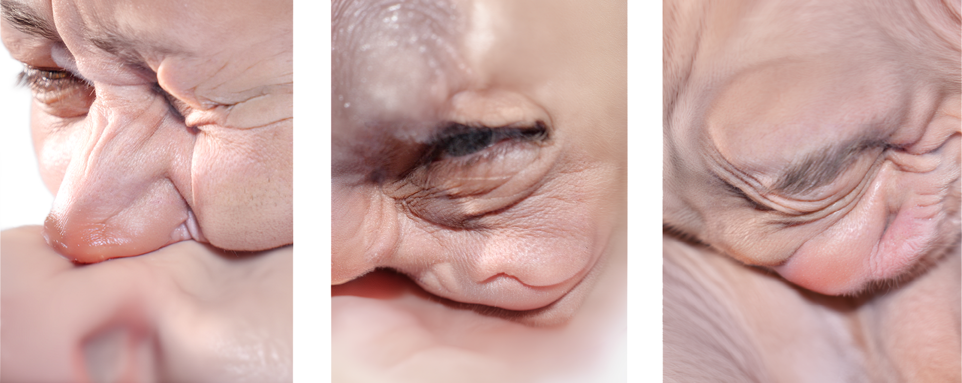 Skin 3